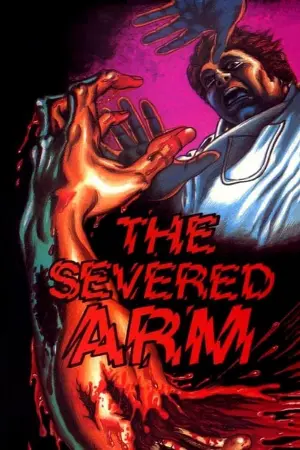 The Severed Arm