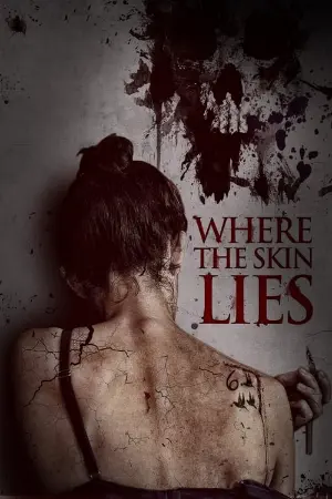 Where the Skin Lies