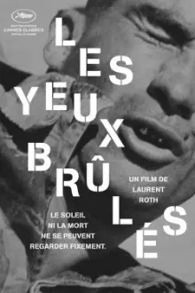 Les yeux brûlés