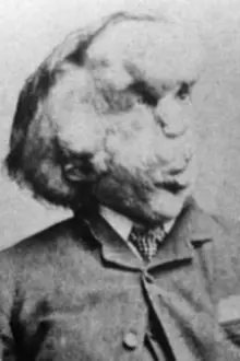 Joseph Merrick como: 