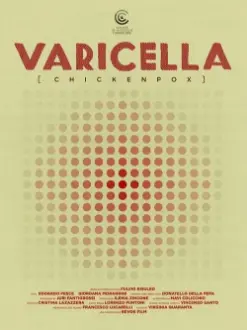 Varicella