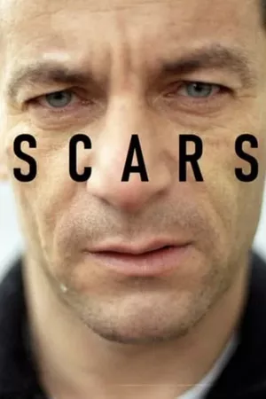 Scars